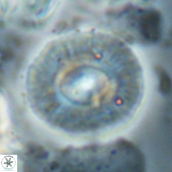Calcidiscus gallagherii VR 028771