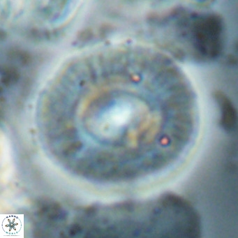 Calcidiscus gallagherii VR 028772