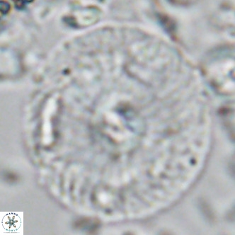 Calcidiscus leptoporus VR 04485