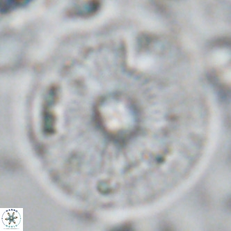 Calcidiscus leptoporus VR 04486