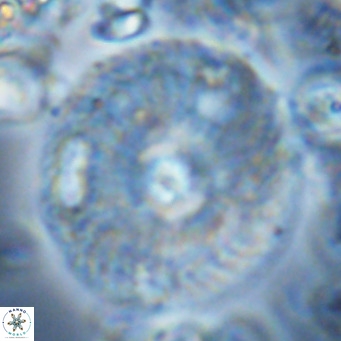 Calcidiscus leptoporus VR 04487