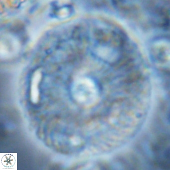 Calcidiscus leptoporus VR 04488