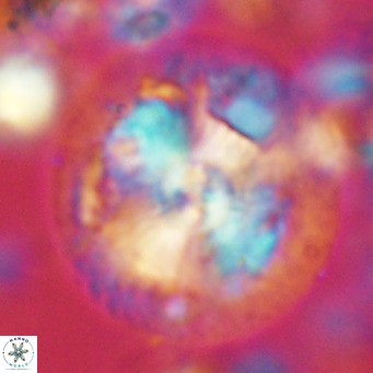Calcidiscus leptoporus VR 04489