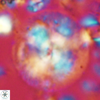 Calcidiscus leptoporus VR 04495