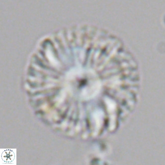 Calcidiscus leptoporus VR 05571