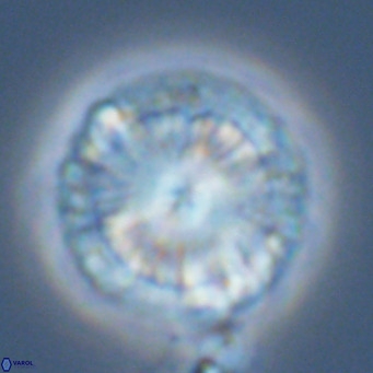 Calcidiscus leptoporus VR 05572