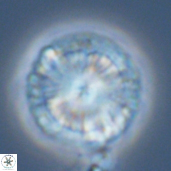 Calcidiscus leptoporus VR 05572