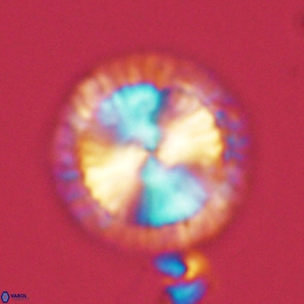 Calcidiscus leptoporus VR 05573