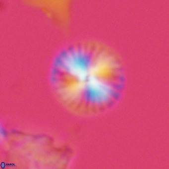 Calcidiscus leptoporus VR 06078