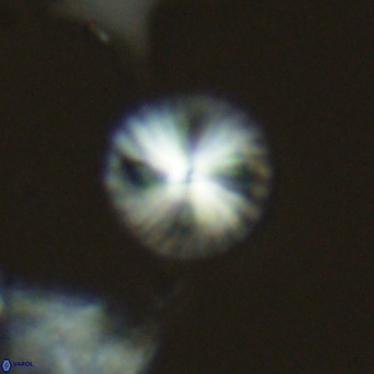 Calcidiscus leptoporus VR 06079