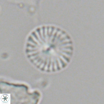 Calcidiscus leptoporus VR 06080
