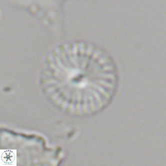 Calcidiscus leptoporus VR 06081
