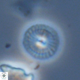 Calcidiscus leptoporus VR 06083