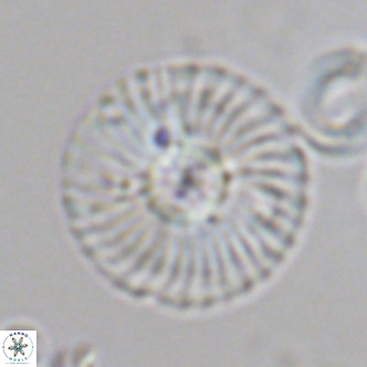 Calcidiscus leptoporus VR 08674