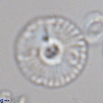 Calcidiscus leptoporus VR 08675