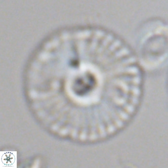 Calcidiscus leptoporus VR 08675