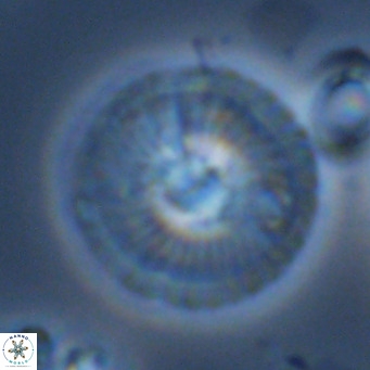 Calcidiscus leptoporus VR 08676