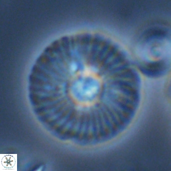 Calcidiscus leptoporus VR 08677