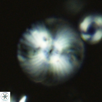 Calcidiscus leptoporus VR 08672