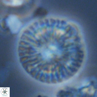 Calcidiscus leptoporus VR 09504