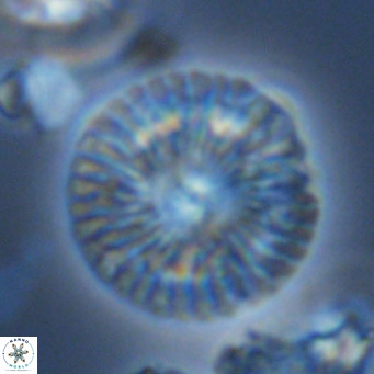 Calcidiscus leptoporus VR 09505