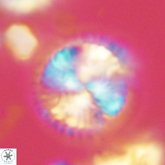 Calcidiscus leptoporus VR 09501