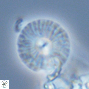 Calcidiscus leptoporus VR 03295