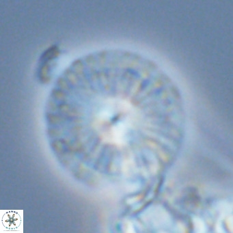 Calcidiscus leptoporus VR 03296