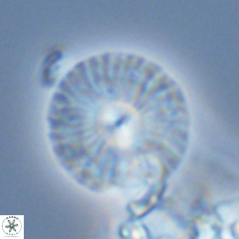 Calcidiscus leptoporus VR 03297