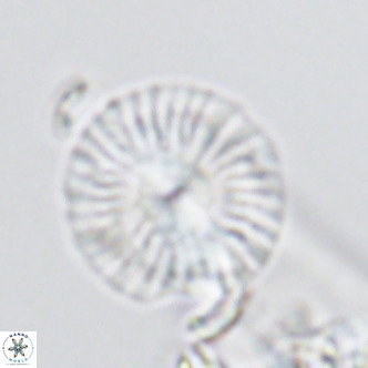 Calcidiscus leptoporus VR 03298