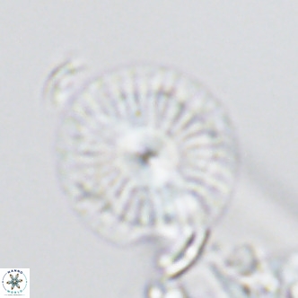 Calcidiscus leptoporus VR 03299