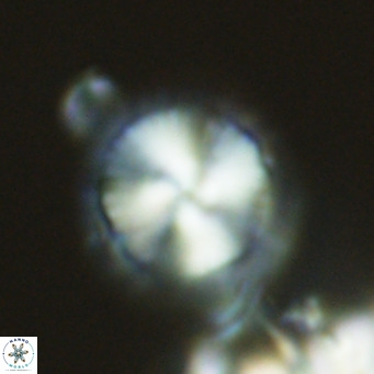 Calcidiscus leptoporus VR 03292
