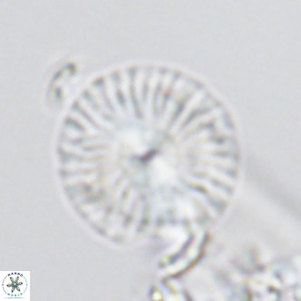 Calcidiscus leptoporus VR 03300