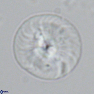 Calcidiscus leptoporus VR 03366