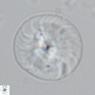 Calcidiscus leptoporus VR 03366