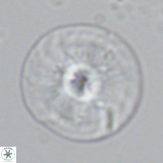 Calcidiscus leptoporus VR 03367