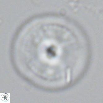 Calcidiscus leptoporus VR 03368