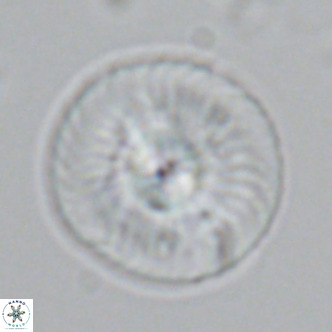 Calcidiscus leptoporus VR 03369