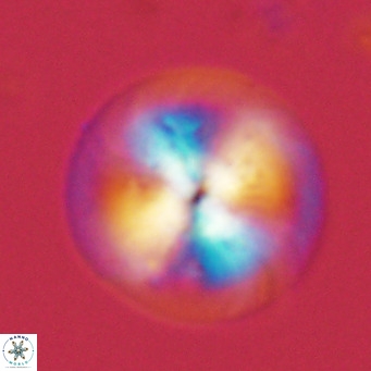 Calcidiscus leptoporus VR 03377