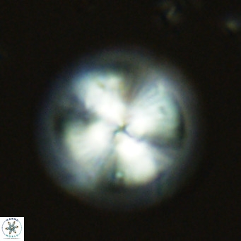 Calcidiscus leptoporus VR 03379