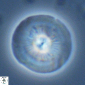 Calcidiscus leptoporus VR 03371