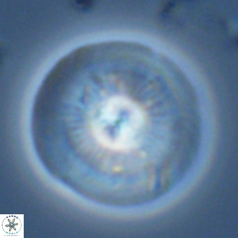 Calcidiscus leptoporus VR 03372
