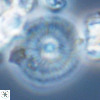 Calcidiscus leptoporus VR 03494