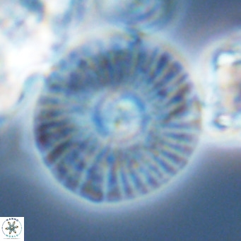 Calcidiscus leptoporus VR 03495