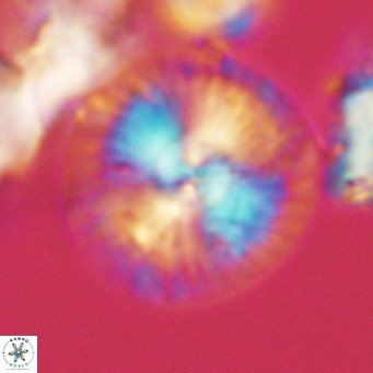 Calcidiscus leptoporus VR 03497