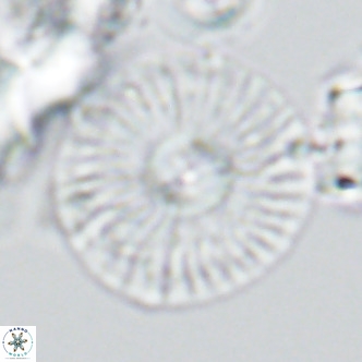 Calcidiscus leptoporus VR 03491