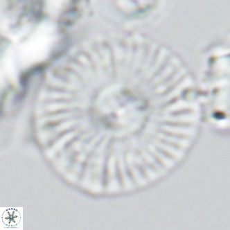 Calcidiscus leptoporus VR 03492