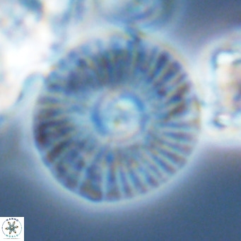 Calcidiscus leptoporus VR 03493
