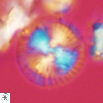 Calcidiscus leptoporus VR 03500
