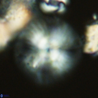 Calcidiscus leptoporus VR 03503